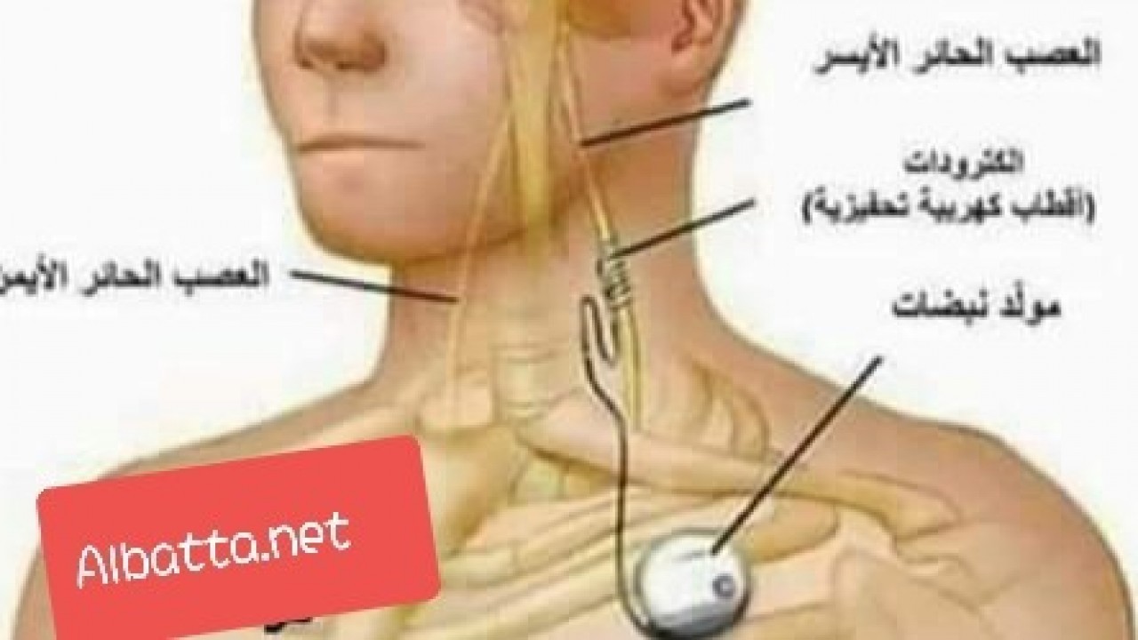 الماء يقتل الإنسان في بعض الأحيان 