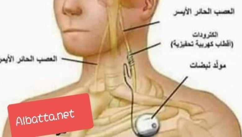 الماء يقتل الإنسان في بعض الأحيان 
