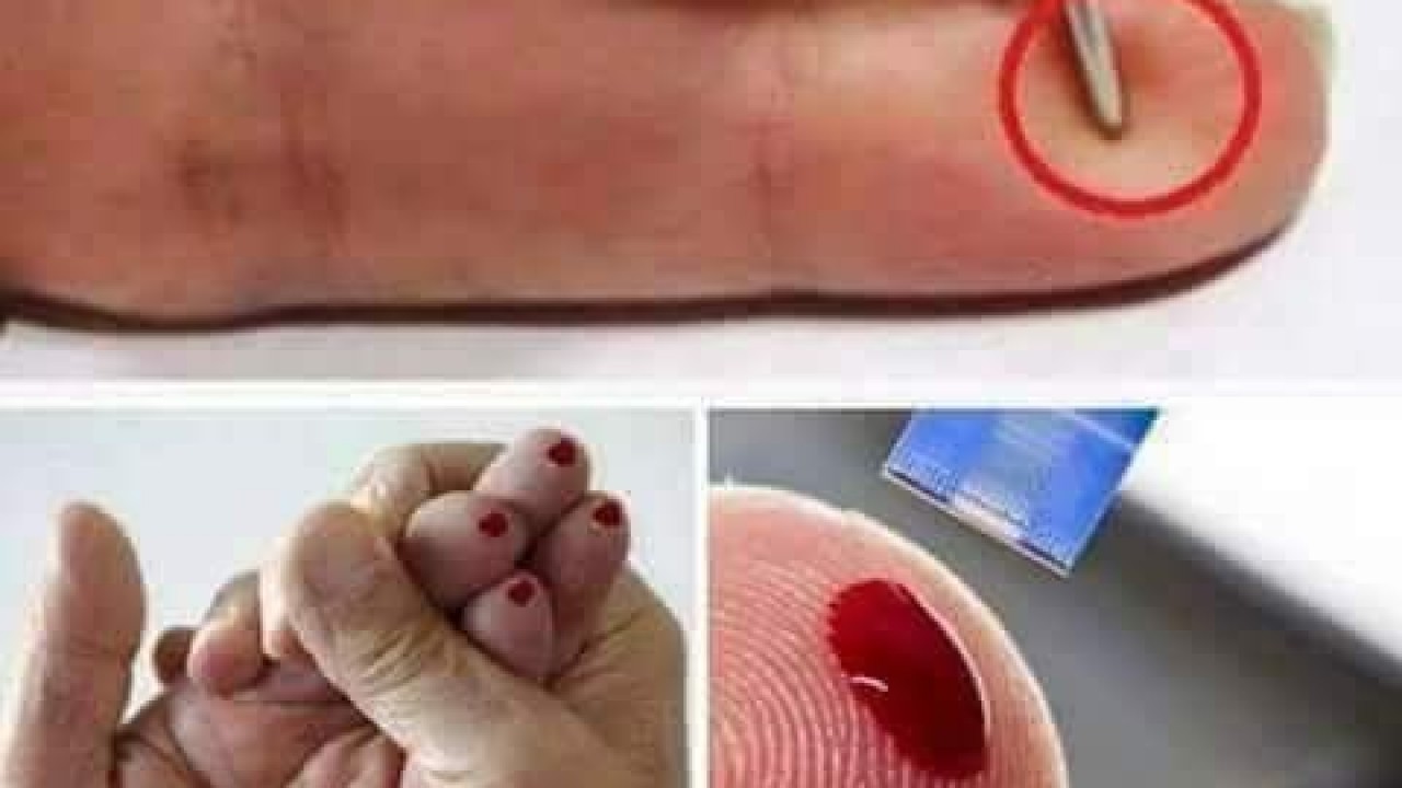 كيف يمكنك تقديم إسعاف أولي لمصاب بجلطة دماغية و إنقاذ حياته