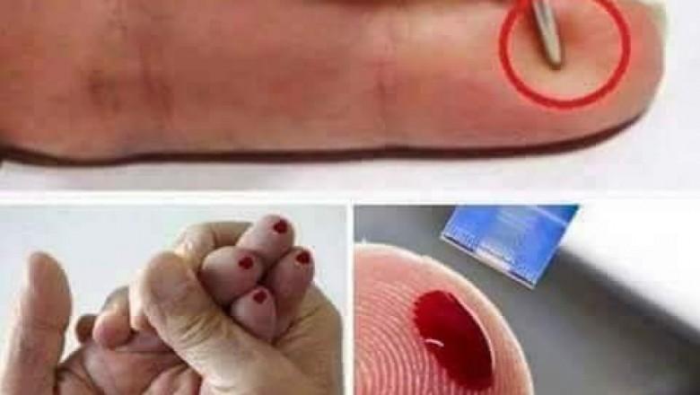 كيف يمكنك تقديم إسعاف أولي لمصاب بجلطة دماغية و إنقاذ حياته